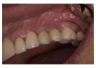 Revive your natural and flawless smiles with holistic Dental care in Tijuana