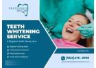 Professional Teeth Whitening Service for a Brighter Smile