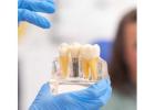 Holistic Dentist in Mexico – Natural, Biocompatible Care for Your Health and Smile